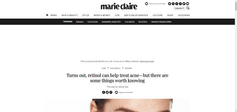 Why-using-retinol-for-acne-treatment-really-does-work-Marie-Claire-UK