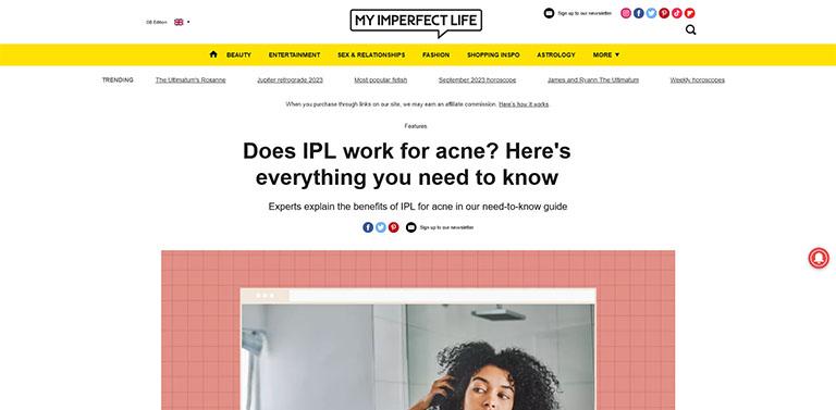does-IPL-work-for-acne